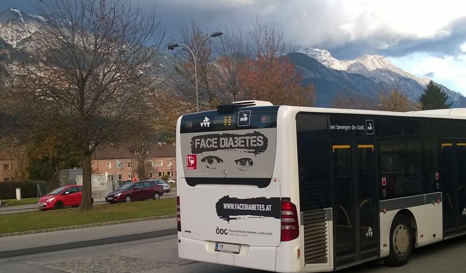 face diabetes in wien