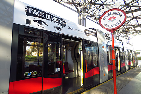 face diabetes in wien